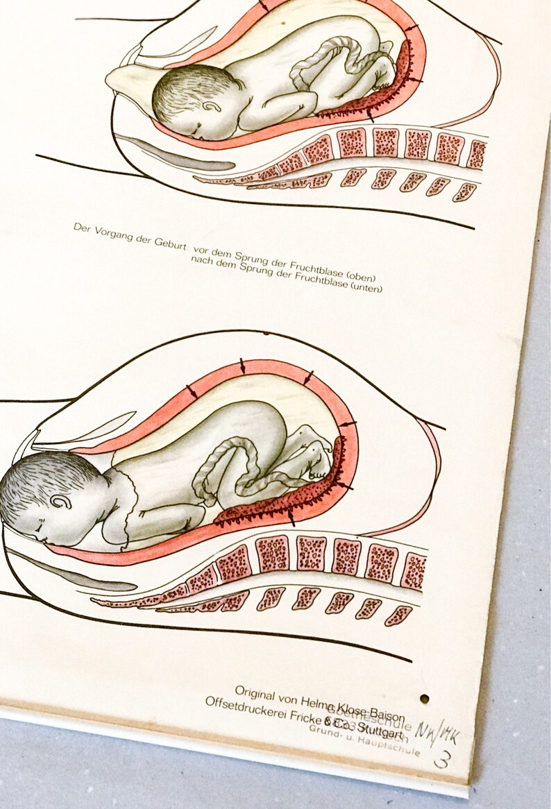 Poster pregnancy and childbirth Vintage School Chart Preganancy Birth Educational Posters School Wall Posters Learning Poster Gynecology
