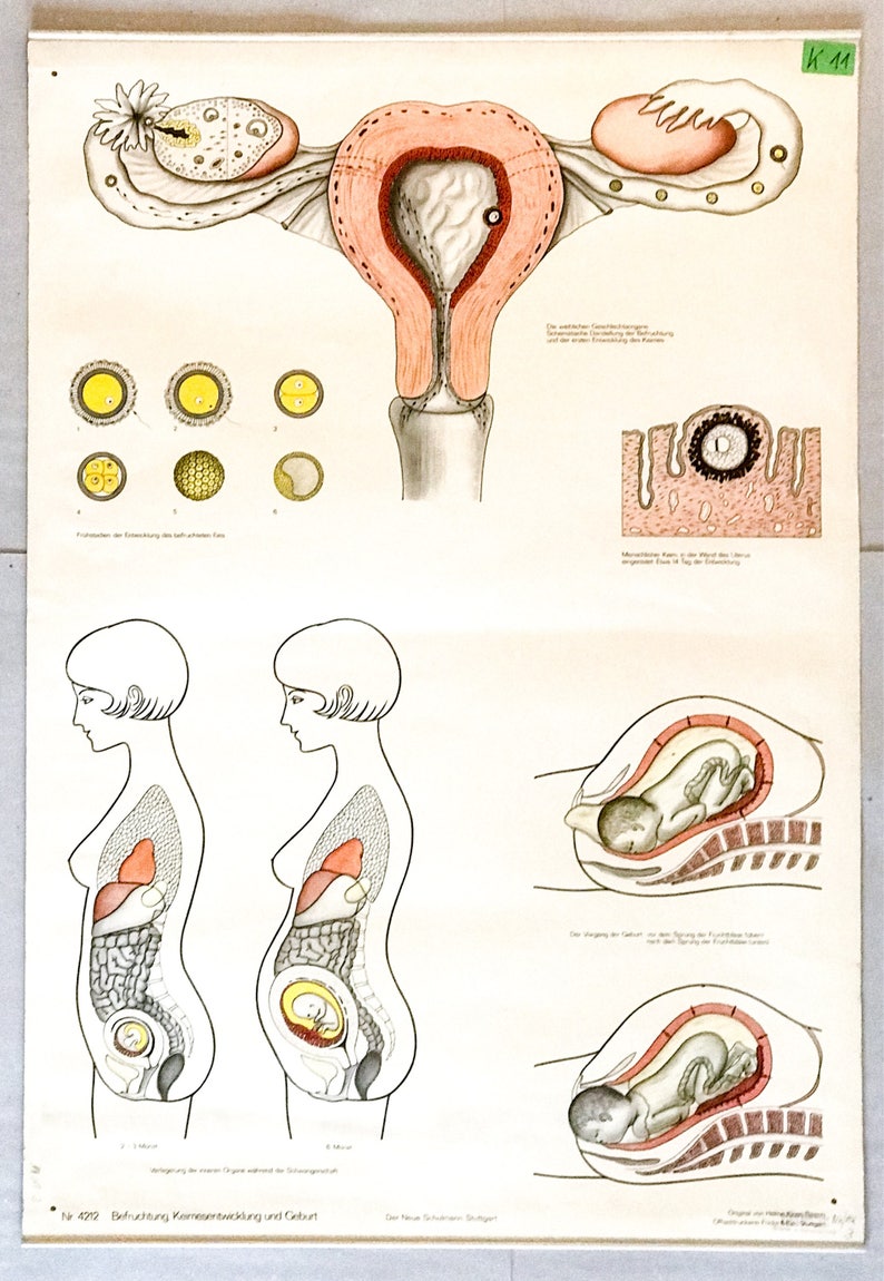 Poster pregnancy and childbirth Vintage School Chart Preganancy Birth Educational Posters School Wall Posters Learning Poster Gynecology