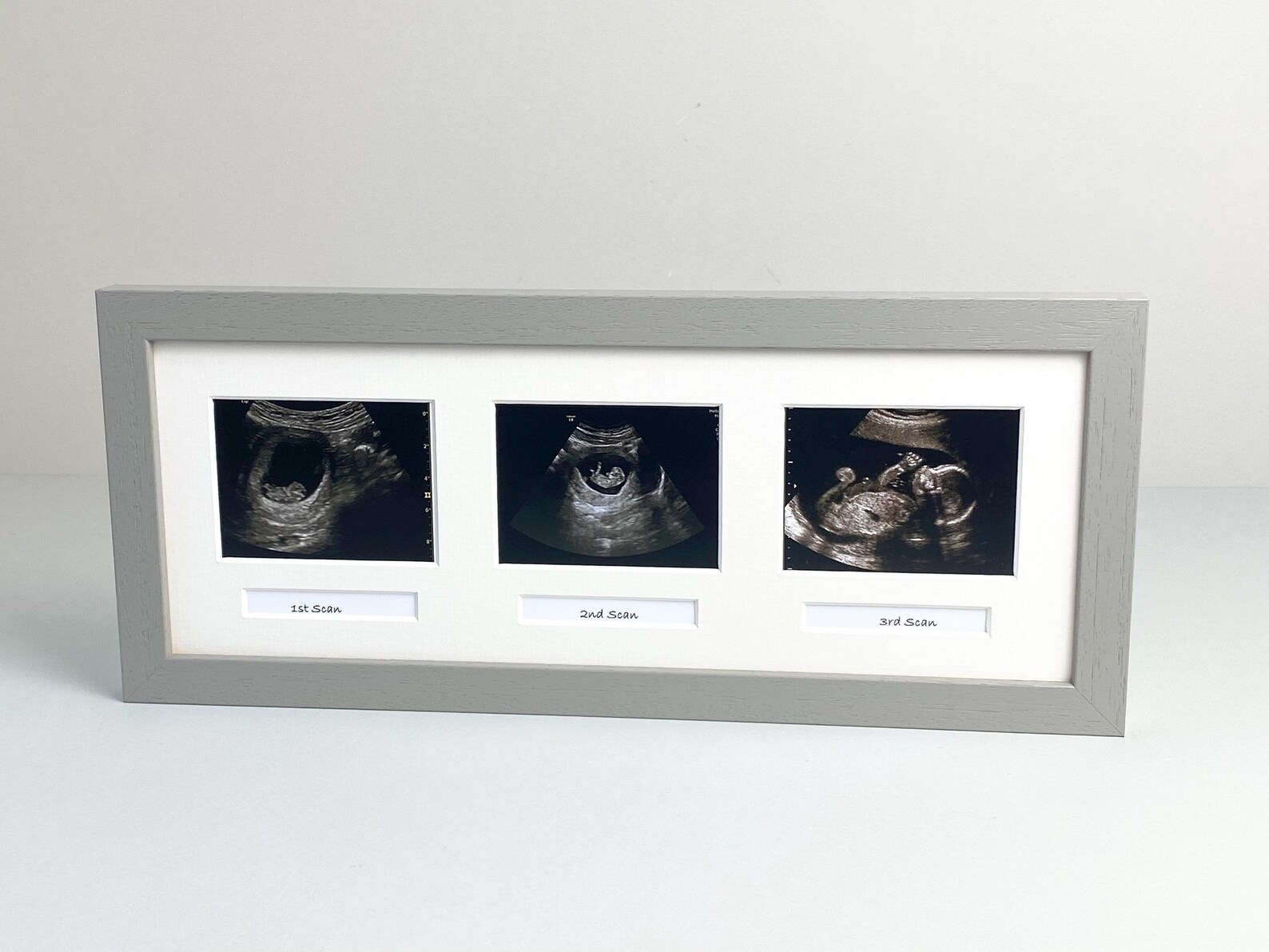 Baby Scan Photo Frame - Multi Aperture Frame for Three Scan Sized ...