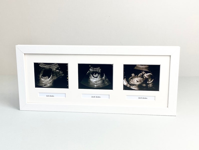 Baby Scan Photo Frame - Multi aperture Frame for Three Scan sized Photos and Three Text Boxes.  Handmade by Art@Home. (BS6) 