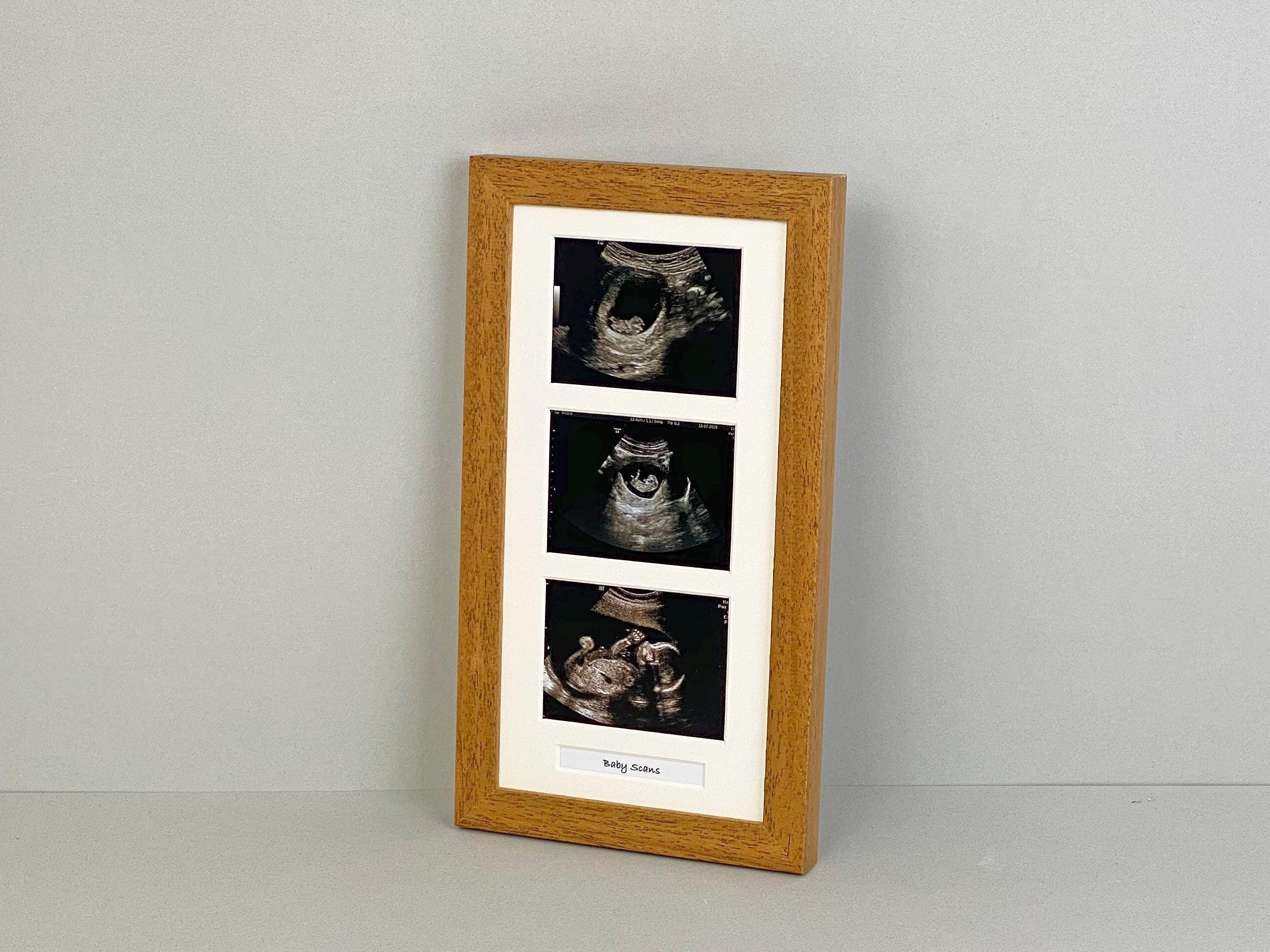 Baby Scan Photo Frame - Multi Aperture Frame for Three Scan Sized ...