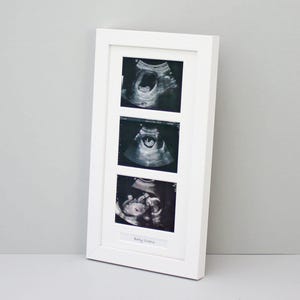 Baby Scan Photo Frame - Multi aperture Frame for Three Scan sized Photos and Text Box.  Handmade. Baby Shower Gift | Pregnancy Announcement