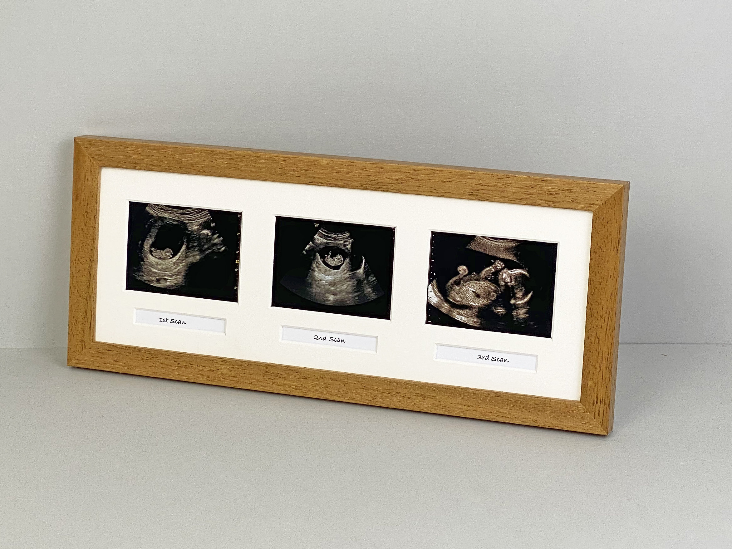 Baby Scan Photo Frame Multi Aperture Frame for Three Scan Etsy UK