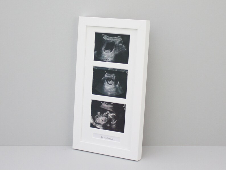 Baby Scan Photo Frame Multi Aperture Frame for Three Scan Etsy UK
