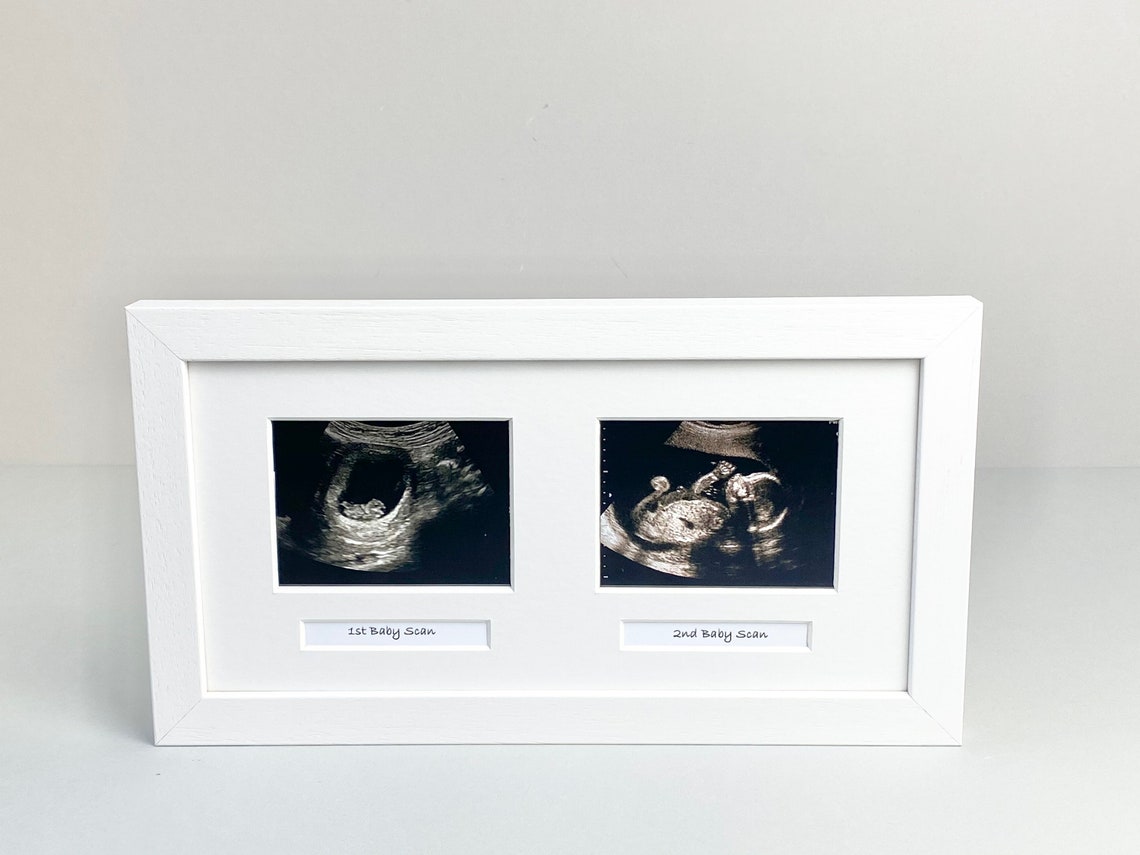 Baby Scan Photo Frame Multi aperture Frame for Two Scan Etsy