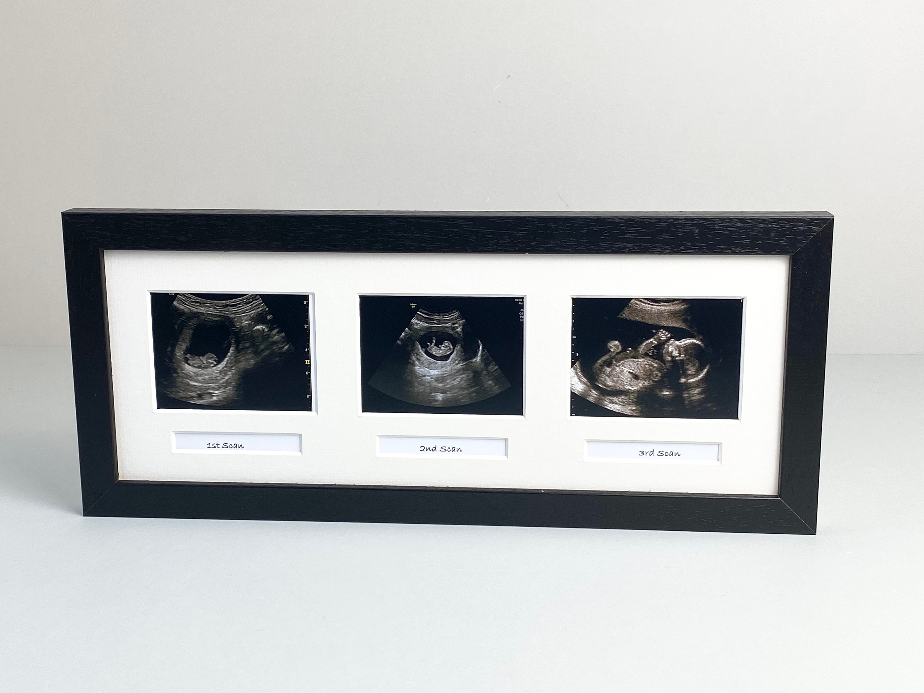Baby Scan Photo Frame Multi Aperture Frame for Three Scan Etsy UK