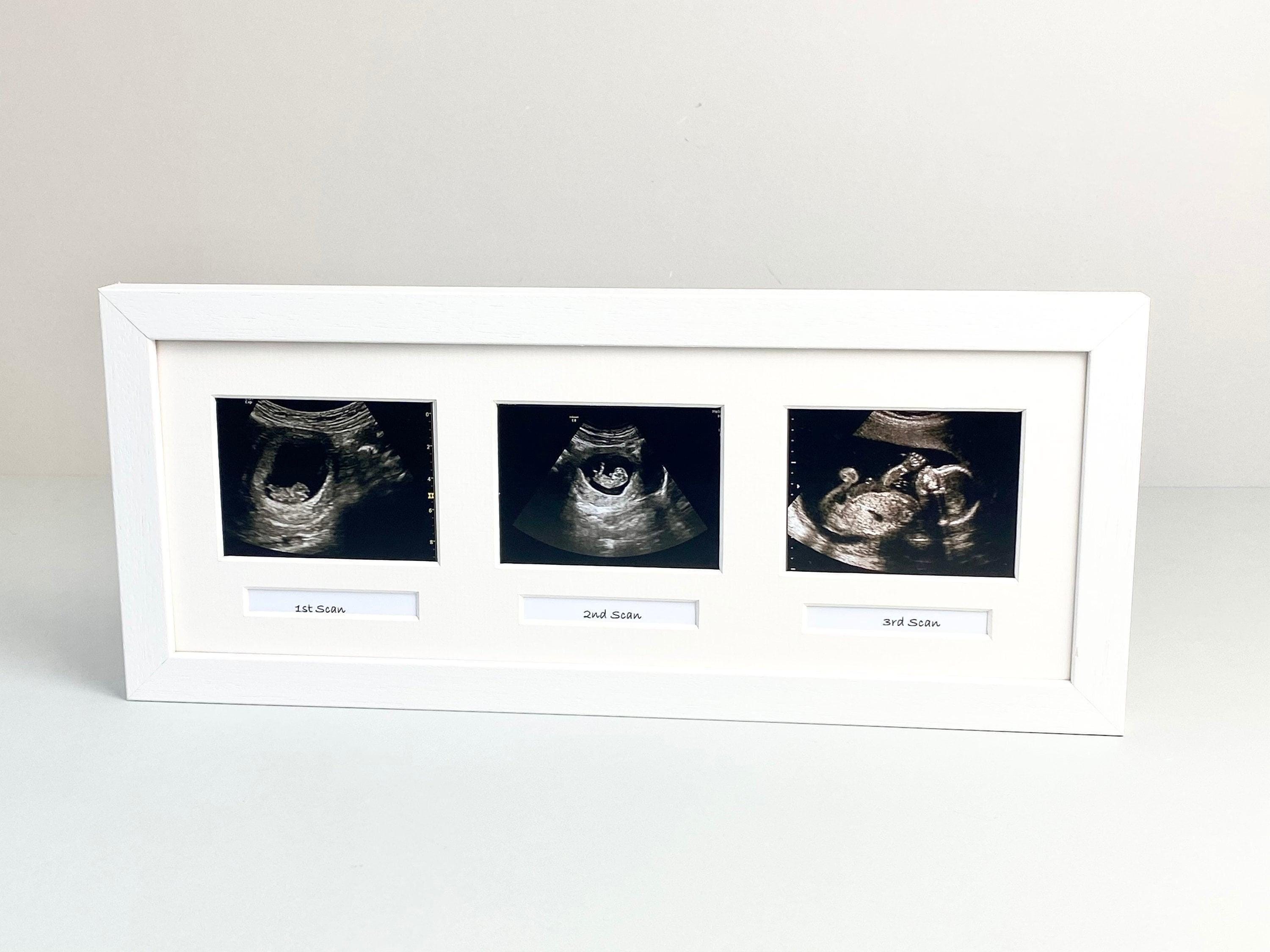 Baby Scan Photo Frame - Multi Aperture Frame for Three Scan Sized ...