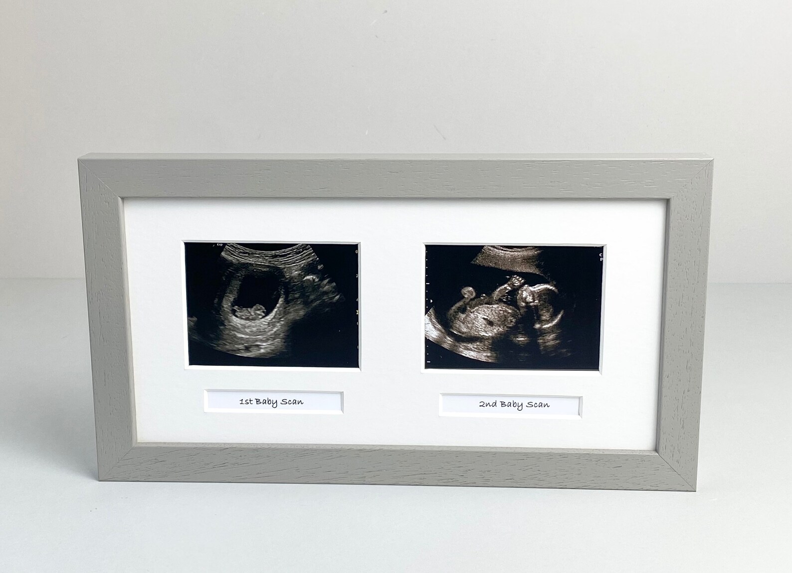 Baby Scan Photo Frame Multi aperture Frame for Two Scan Etsy