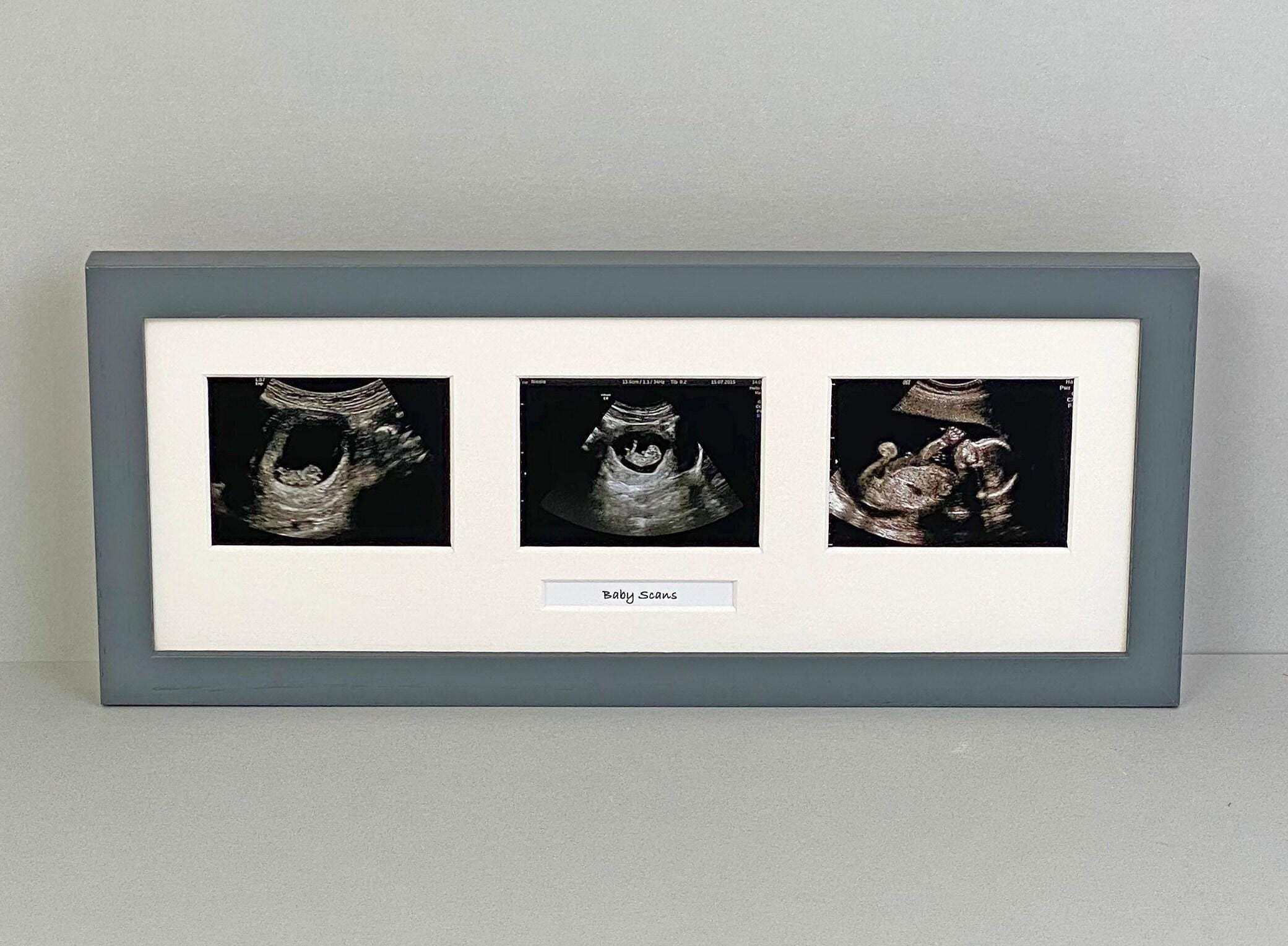 Baby Scan Photo Frame - Multi Aperture Frame for Three Scan Sized ...