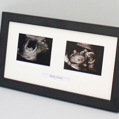 Baby Scan Photo Frame Multi Aperture Frame for Three Scan Etsy