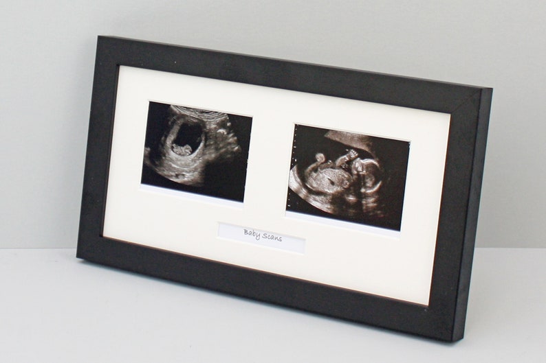 Baby Scan Photo Frame Multi Aperture Frame for Two Scan Etsy Ireland