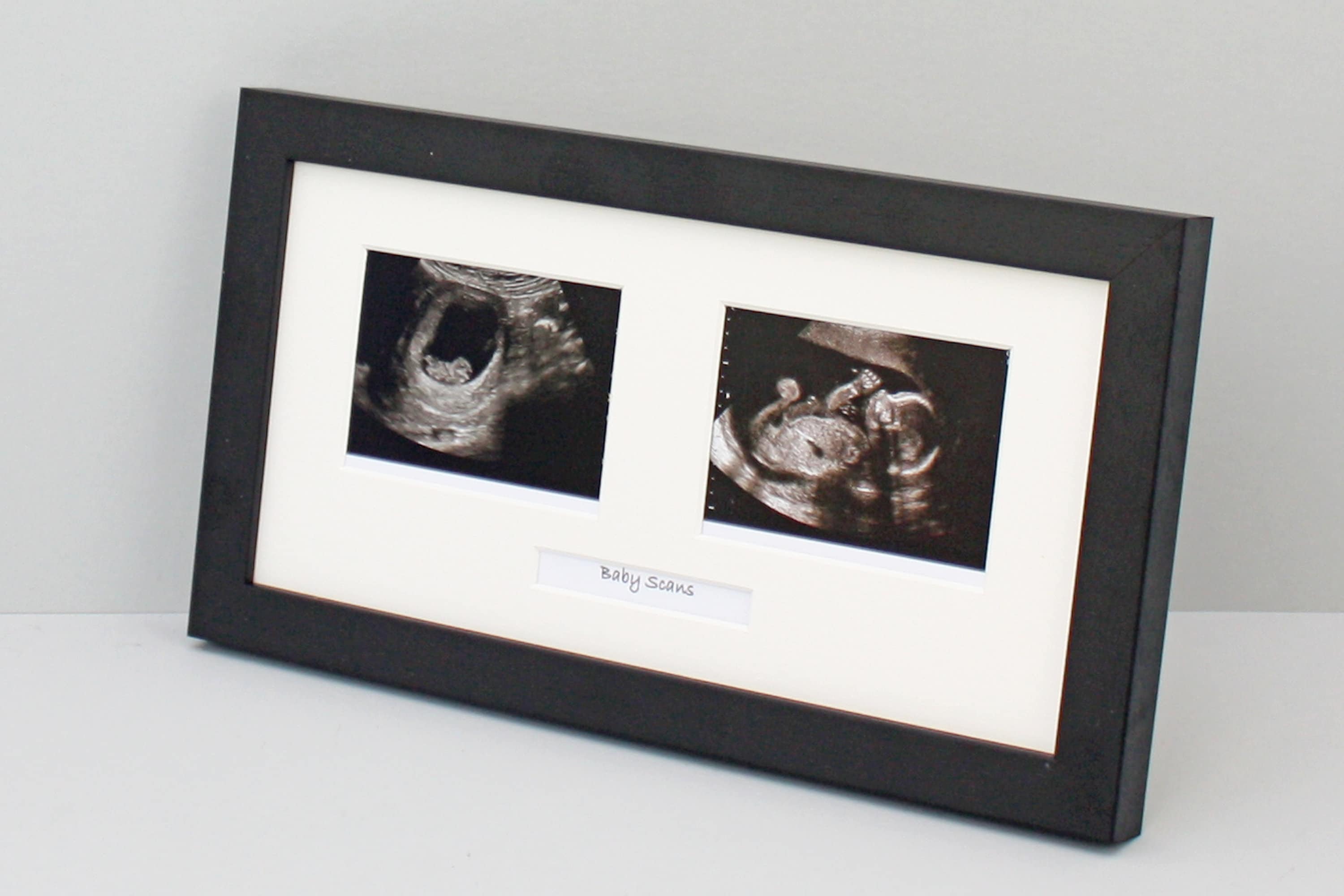Baby Scan Photo Frame Multi Aperture Frame for Two Scan Etsy Ireland