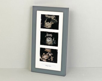 Baby Pregnancy 12 week Scan 1st Photo Hand Made 4 Aperture Black Frame & Mount 