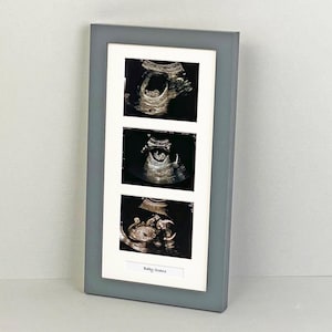 Baby Scan Photo Frame - Multi aperture Frame for Three Scan sized Photos and Text Box. Handmade. Baby Shower Gift | Pregnancy Announcement