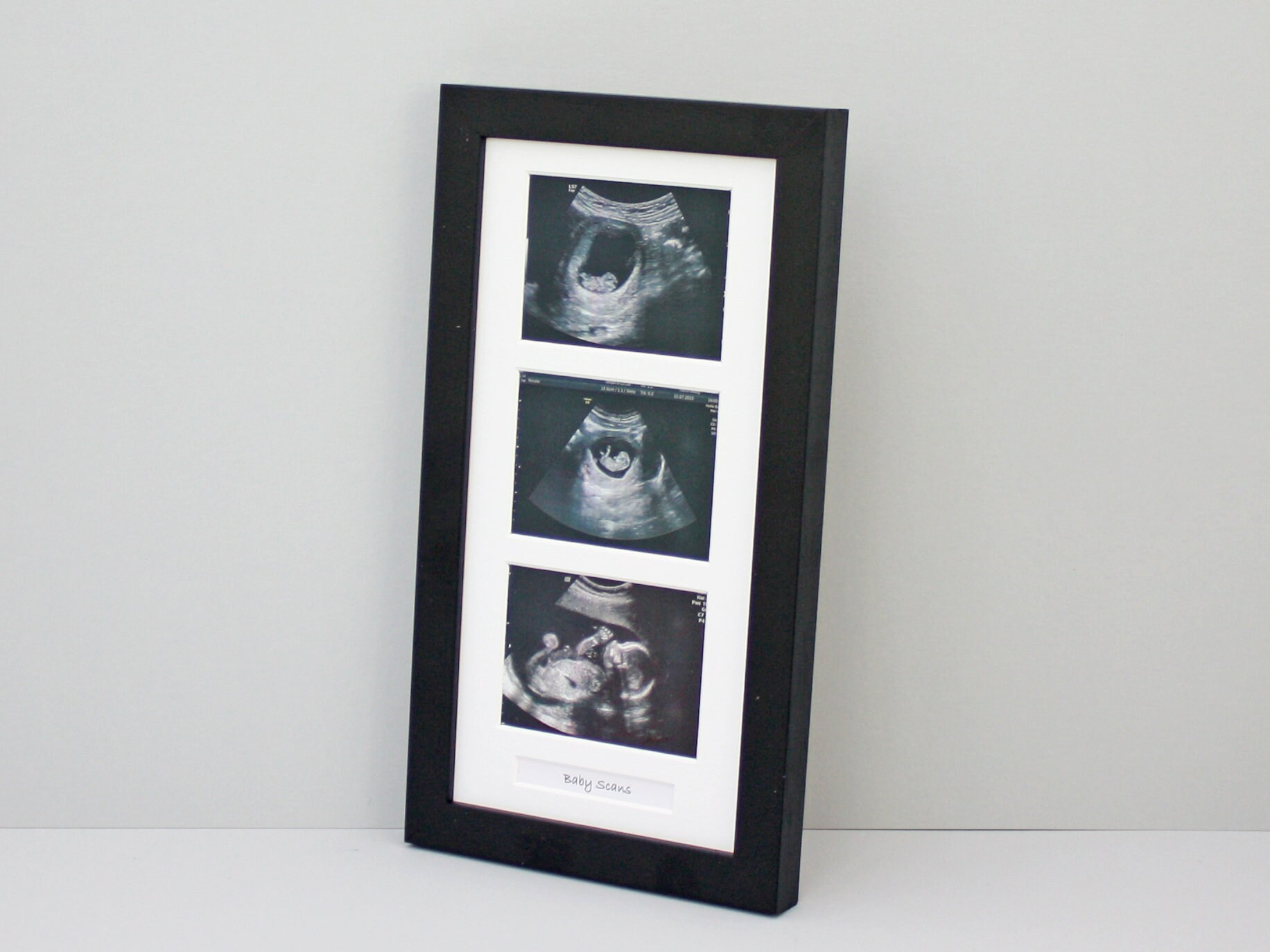 Baby Scan Photo Frame Multi Aperture Frame for Three Scan Etsy