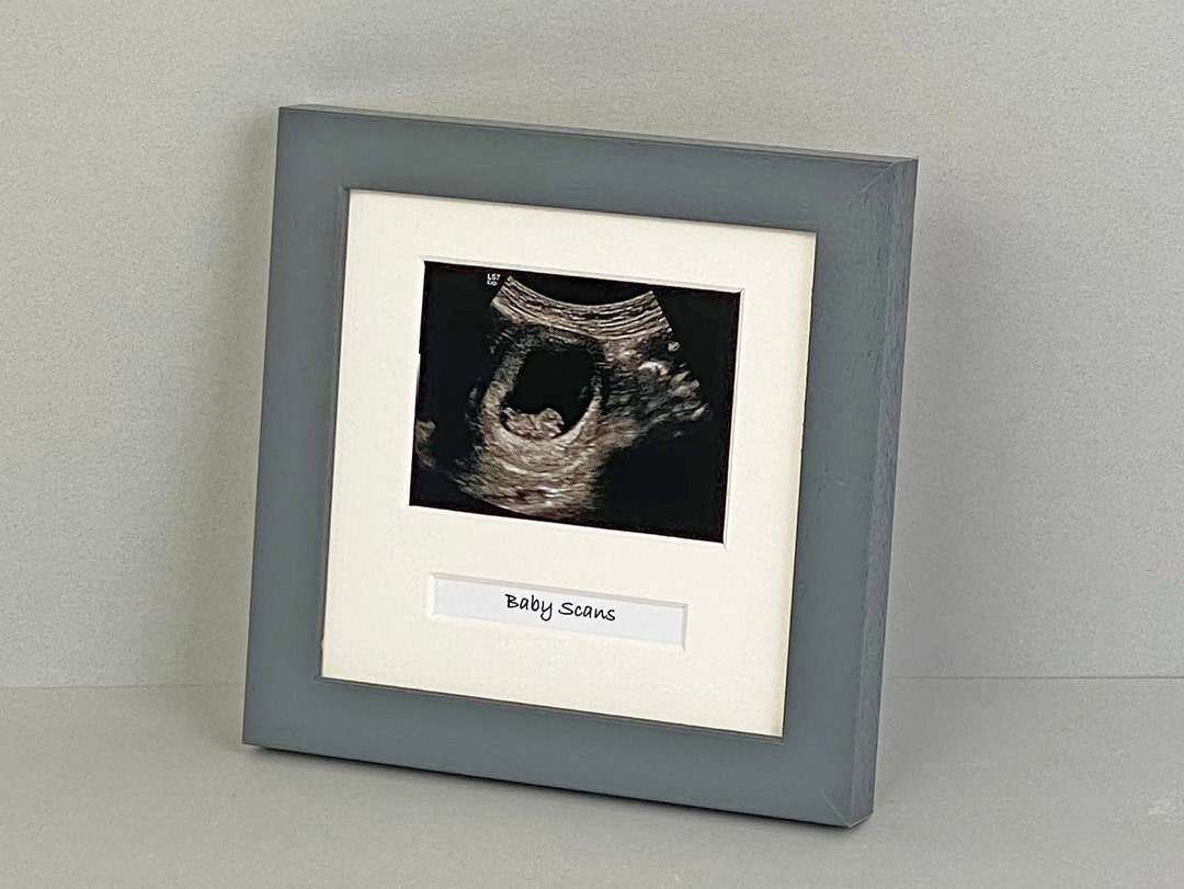 Baby Scan Photo Frame Multi Aperture Frame for Scan Sized Photo and