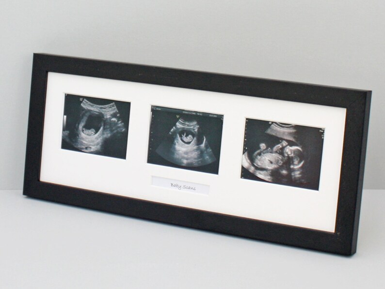 Baby Scan Photo Frame Multi Aperture Frame for Three Scan Etsy UK