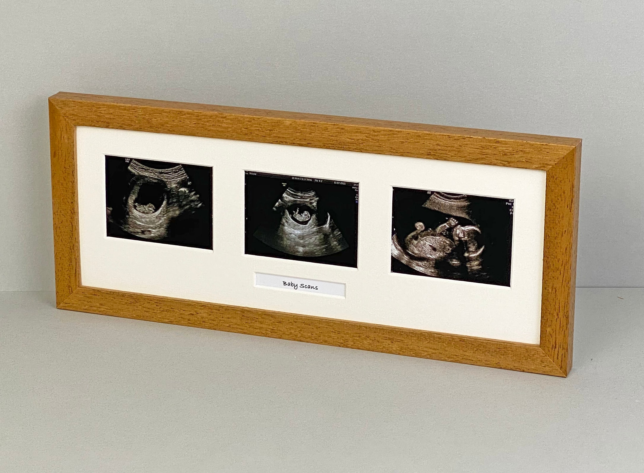 Baby Scan Photo Frame Multi Aperture Frame for Three Scan Etsy UK