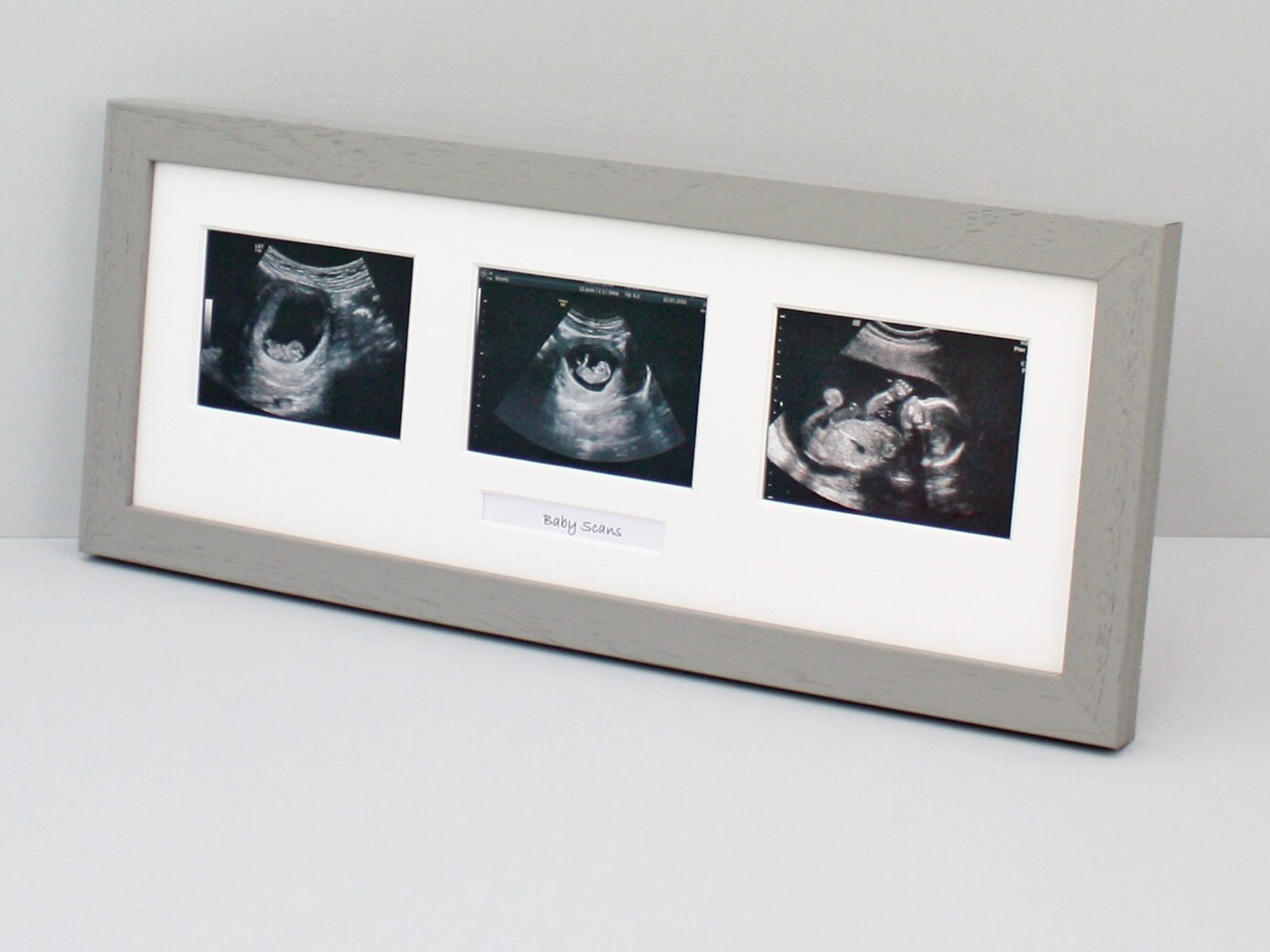 Baby Scan Photo Frame Multi Aperture Frame for Three Scan Etsy UK