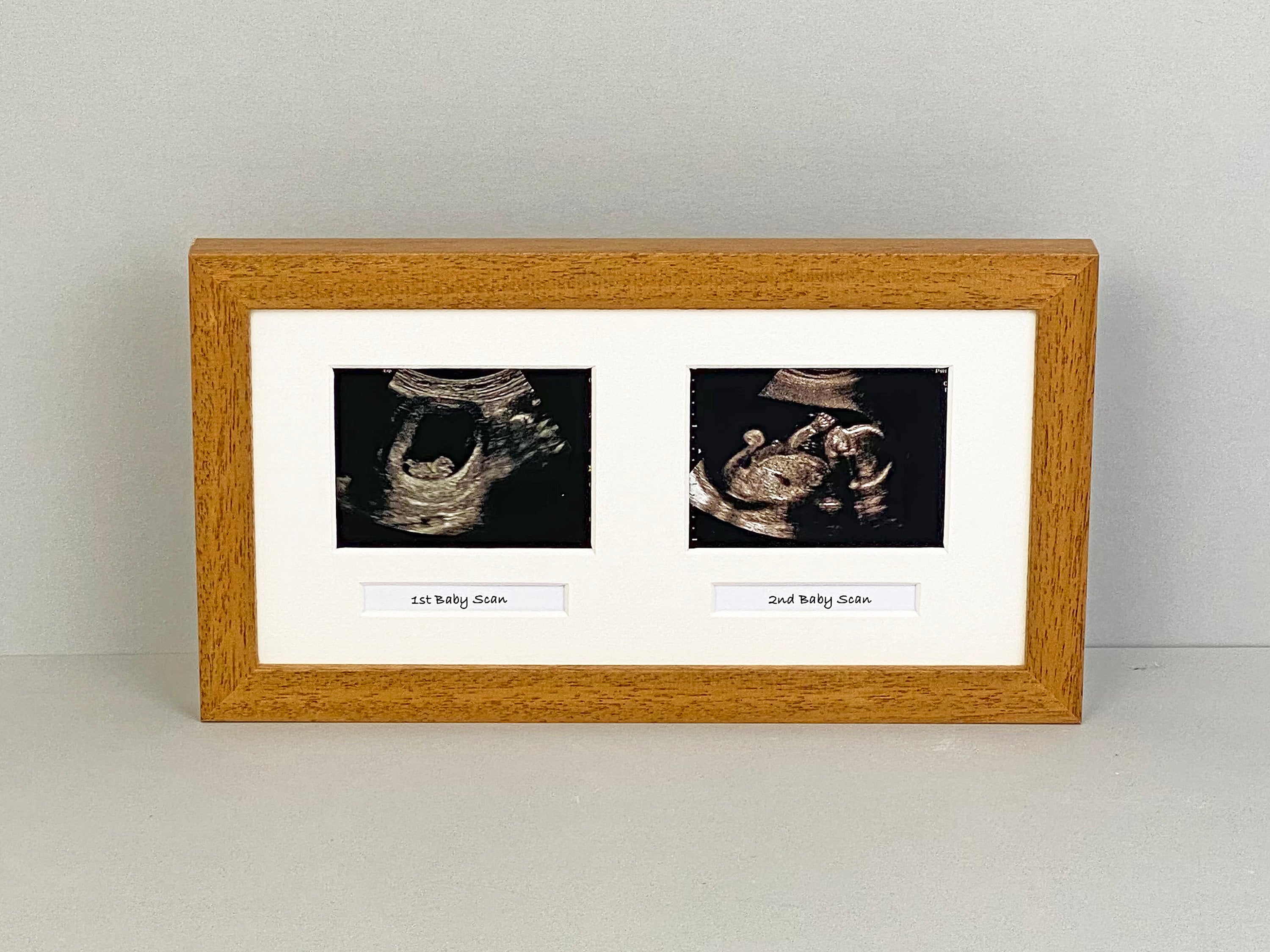 Baby Scan Photo Frame Multi aperture Frame for Two Scan Etsy