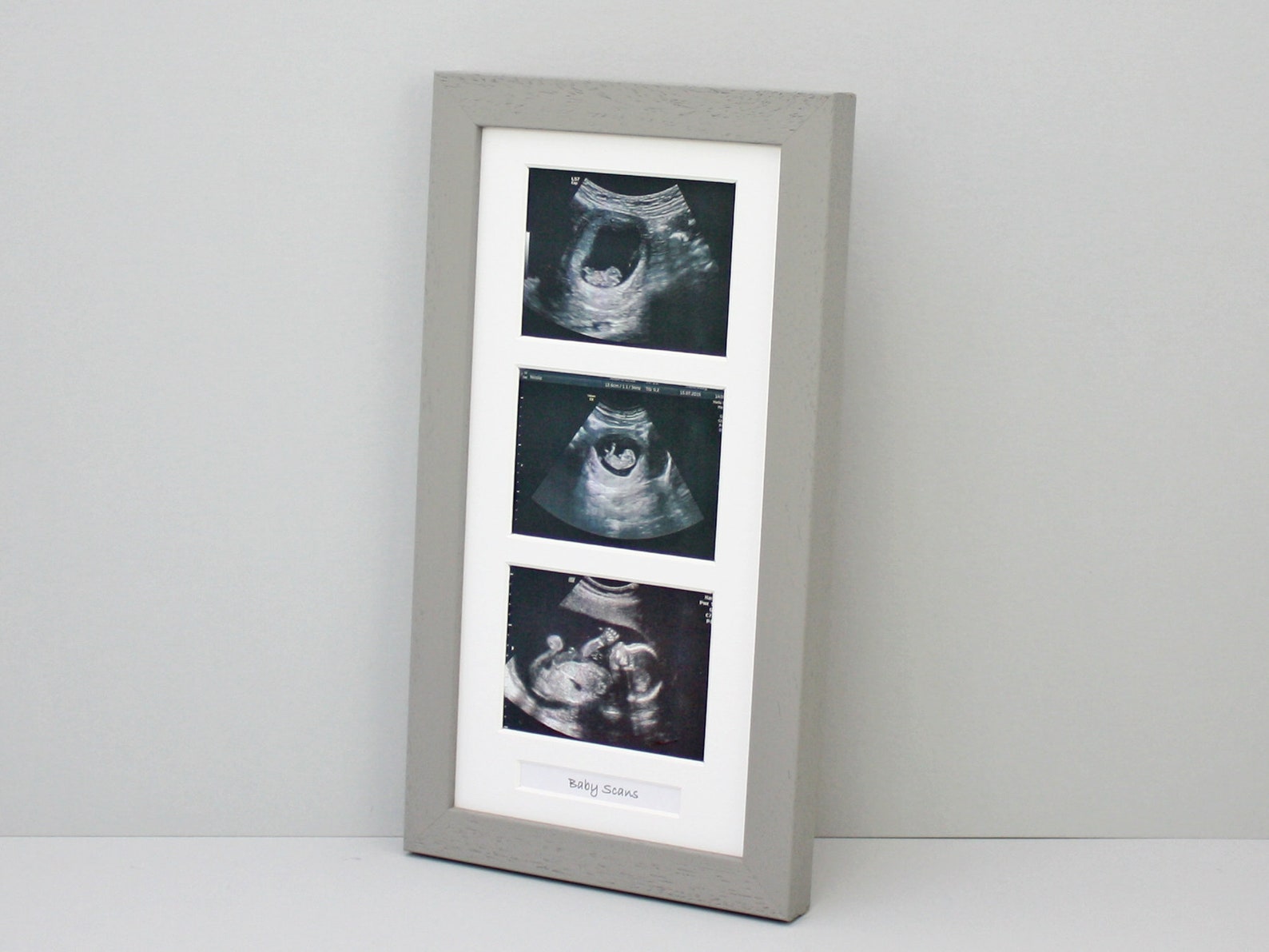 Baby Scan Photo Frame Multi Aperture Frame for Three Scan Etsy
