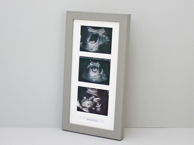 Baby Scan Photo Frame Multi Aperture Frame for Three Scan Etsy