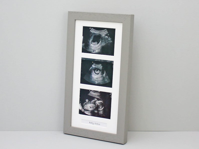 Baby Scan Photo Frame - Multi Aperture Frame for Three Scan Sized ...