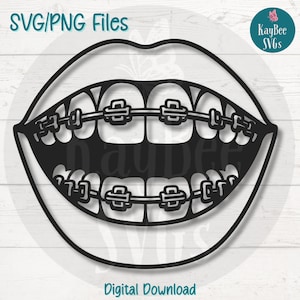 Archivos de corte SVG/PNG de aparatos de ortodoncia para Cricut, Silhouette, descarga digital, imágenes prediseñadas imprimibles, imágenes prediseñadas para uso comercial, sublimación