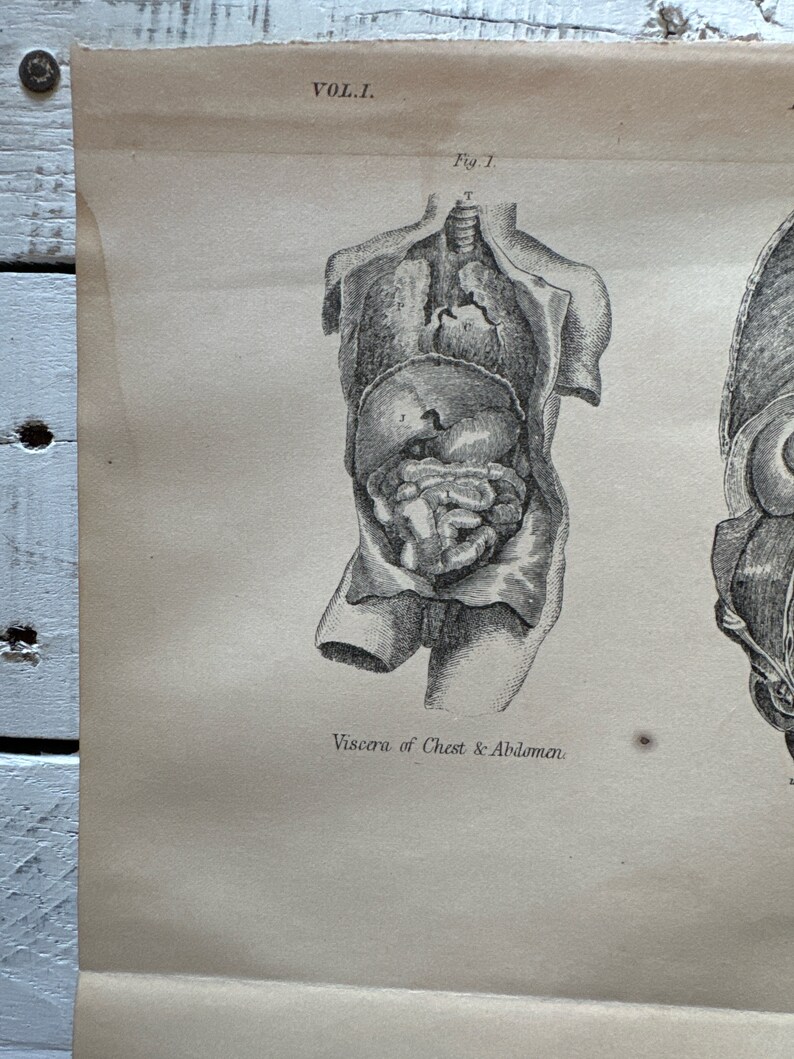 Antique Human Anatomy Print: 1891 Medical Book Plate - Etsy