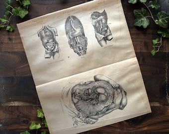 Antique Human Anatomy Print: 1891 Medical Book Plate