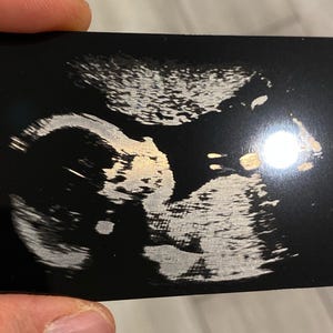 Carte photo Baby Scan, cadeau Baby Scan avec portefeuille en métal, cadeau pour nouveau papa - souvenir de grossesse, nouveau cadeau grand-père, cadeau échographie
