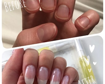 Nagelgroeiserum | Nagelriem- en nagelolie voor gebarsten en broze nagels | Dierproefvrij | Veganistisch
