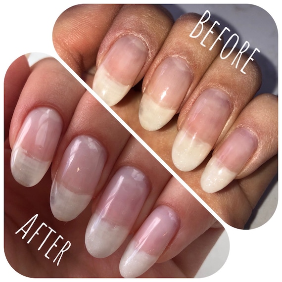 Nail Growth Serum Cuticle Nail Oil for Cracked & Brittle - Etsy Nail Growth Serum Cuticle Nail Oil for Cracked & Brittle - Etsy