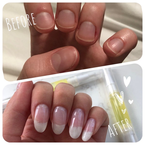 Nail Growth Serum | Cuticle + Nail Oil For Cracked & Brittle Nails | Cruelty-Free | Vegan