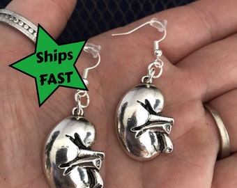 Kidney Earrings