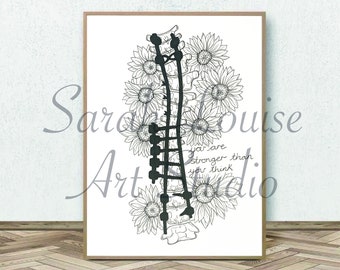 A4 Custom Hand Drawing Spinal Fusion / Scoliosis (One line drawing, minimalistic, floral, pen drawing, personal, unique)