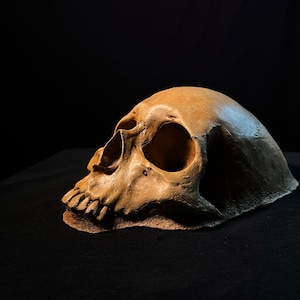 May include: A close-up of a human skull, with the left side of the skull facing the viewer. The skull is a light brown color and is resting on a black surface.