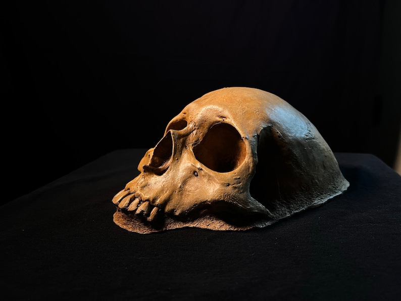 May include: A close-up of a human skull, with the left side of the skull facing the viewer. The skull is a light brown color and is resting on a black surface.