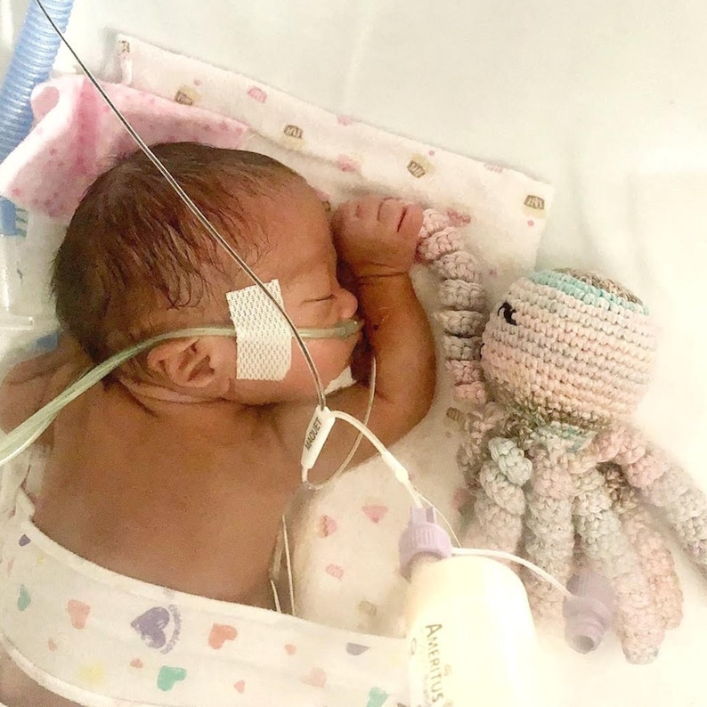 Puede incluir: Un reci&eacute;n nacido yace en una cama de hospital, conectado a equipos m&eacute;dicos. Junto al beb&eacute; hay un juguete de pulpo de ganchillo en colores pastel. El beb&eacute; lleva un pa&ntilde;al con dibujos de corazones y estrellas.