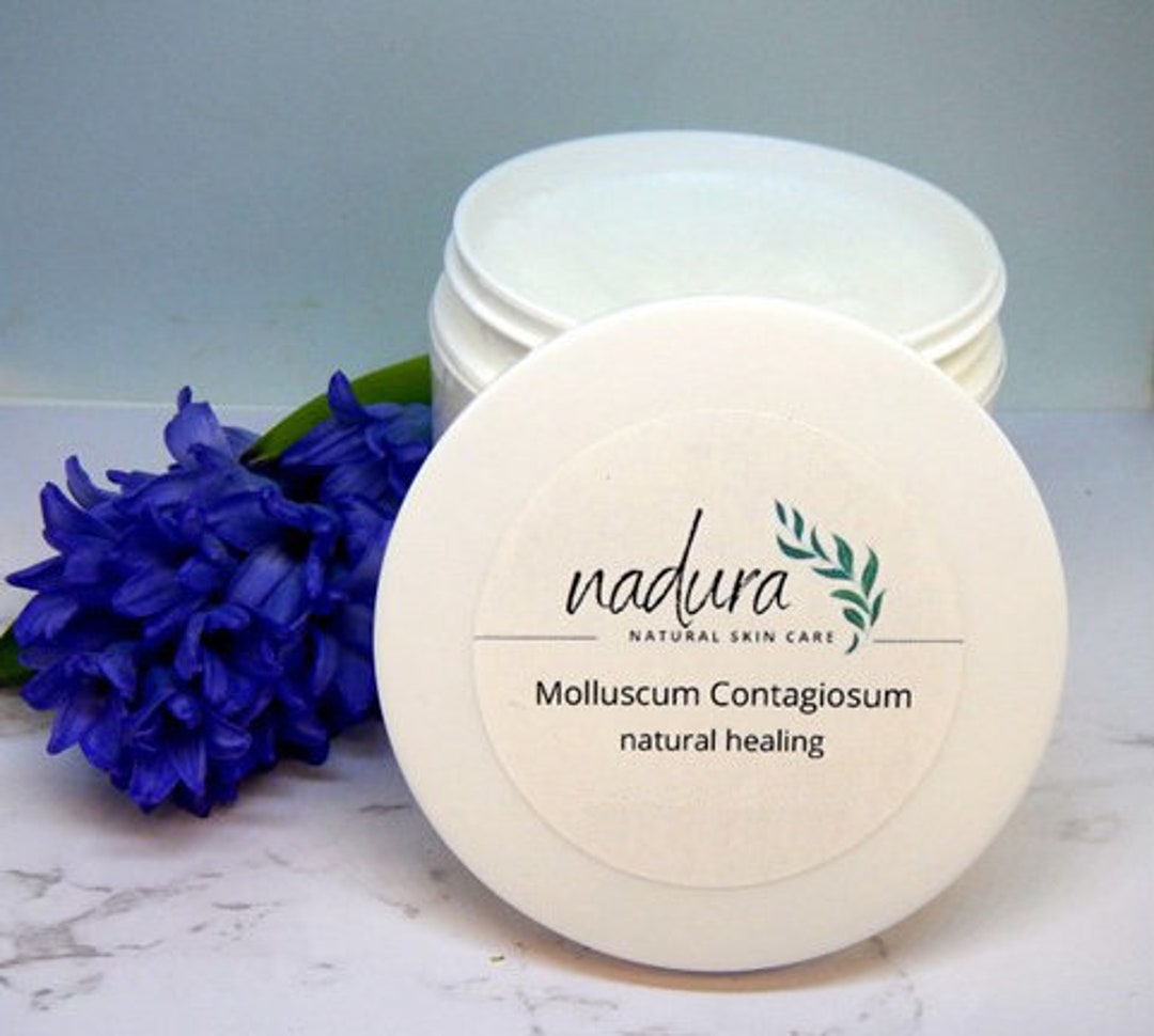 Molluscum Contagiosum Water Warts Cream Lotion Natural Etsy