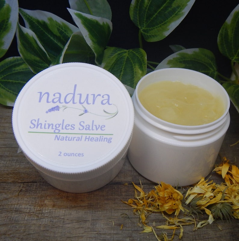 Healing Shingles Salve Shingles Lotion Shingles Cream Etsy