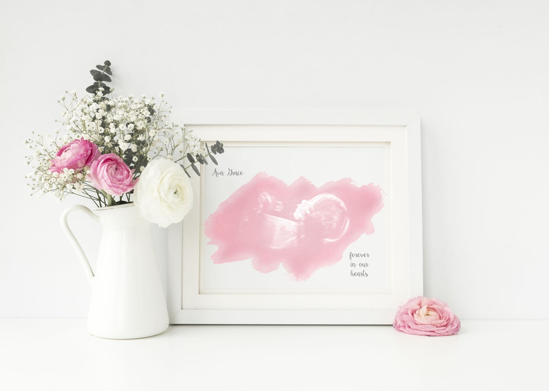 Custom Ultrasound Print, Miscarriage Ultrasound Keepsake, Personalized Stillborn Print, Sonogram