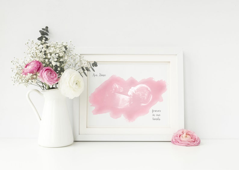 Twin Baby Ultrasound Art, Sonogram Gifts, Miscarriage Memorial, Infant Loss Gifts, Baby Memorial, Stillbirth, A Beautiful Remembrance image 4
