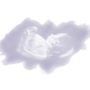 Custom Ultrasound Print, Miscarriage Ultrasound Keepsake, Personalized Stillborn Print, Sonogram Memorial Art, Watercolor Ultrasound image 8