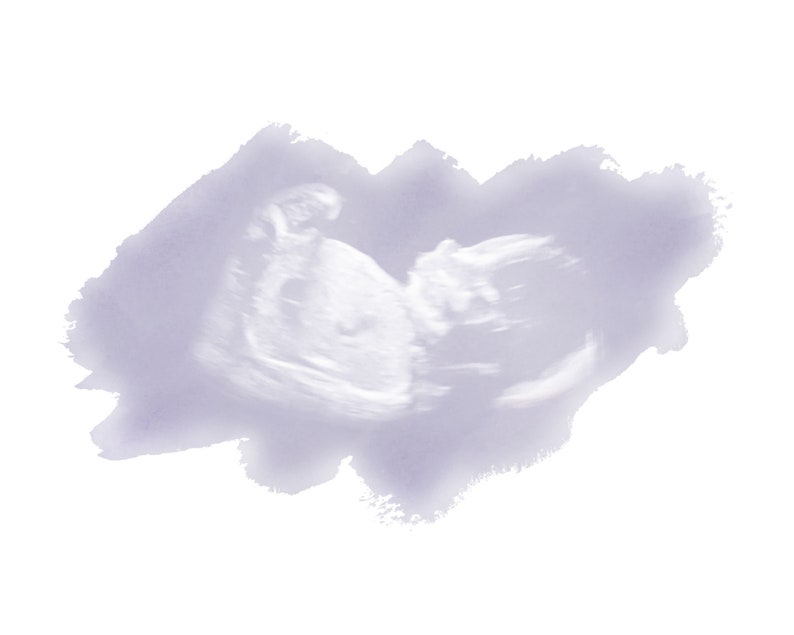 Custom Ultrasound Print, Miscarriage Ultrasound Keepsake, Personalized Stillborn Print, Sonogram Memorial Art, Watercolor Ultrasound image 8