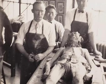 Antique Medical Post Mortem Photo 1766 Oddleys Strange & Bizarre
