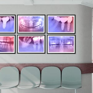 Stampa artistica da parete per clinica odontoiatrica, stampa artistica da parete per interni di clinica odontoiatrica con radiografia colorata - Blush Radiograph