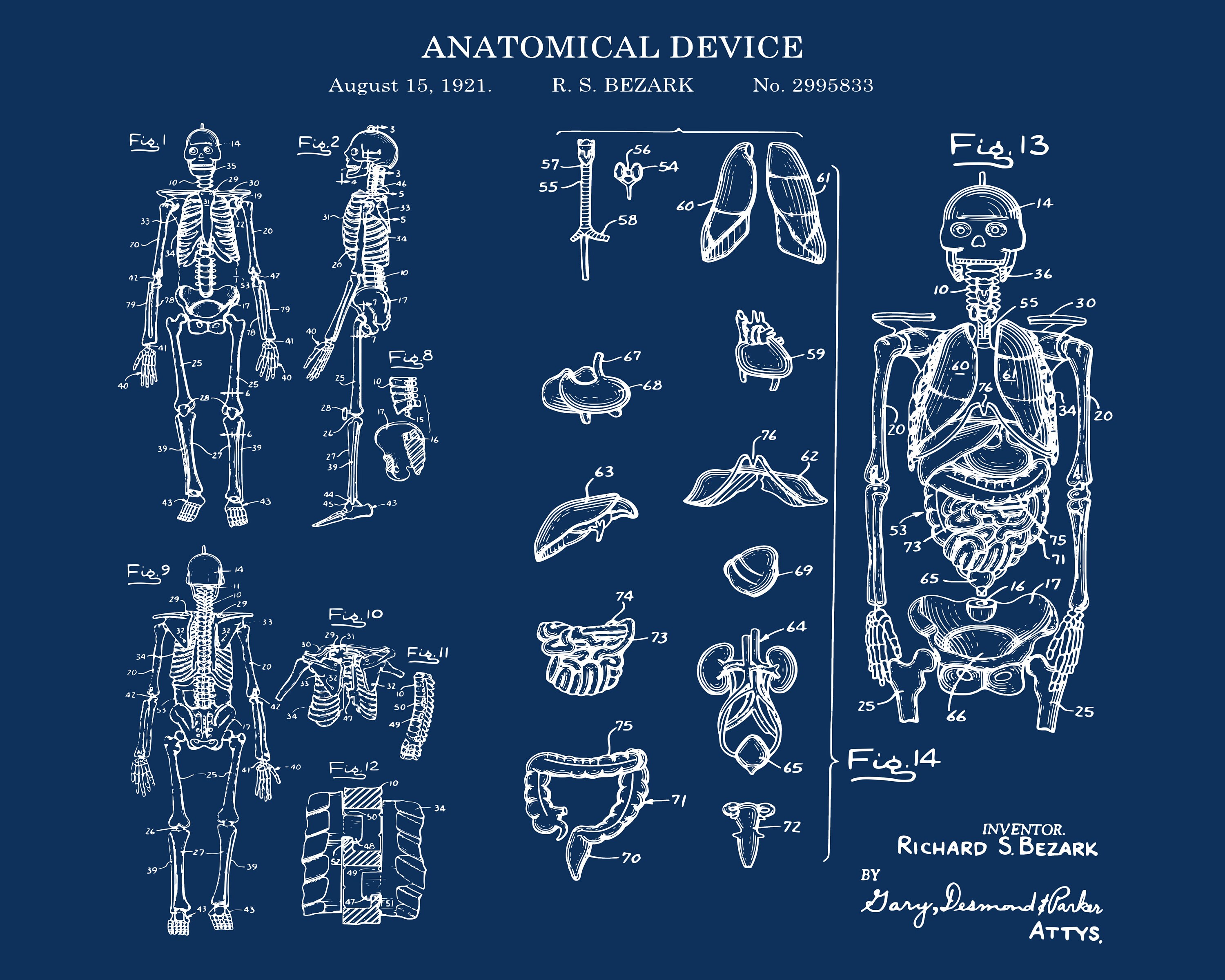 Anatomical Skeleton Blueprint Poster: Medical Student Gift (digital ...