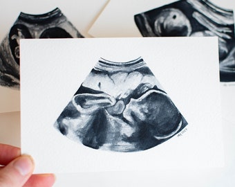 Watercolor Ultrasound Painting, Custom Sonogram, Ultrasound Painting Miscarriage,  Sonagram Painting, Miscarriage Gift, Baby Shower Gift