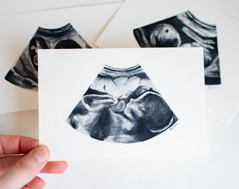 Watercolor Ultrasound Painting, Custom Sonogram, Ultrasound Painting Miscarriage,  Sonagram Painting, Miscarriage Gift, Baby Shower Gift